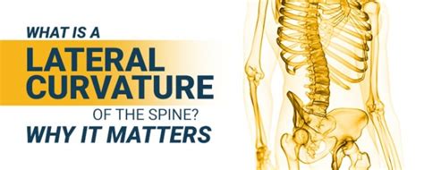 What Is A Lateral Curvature Of The Spine? Why It Matters