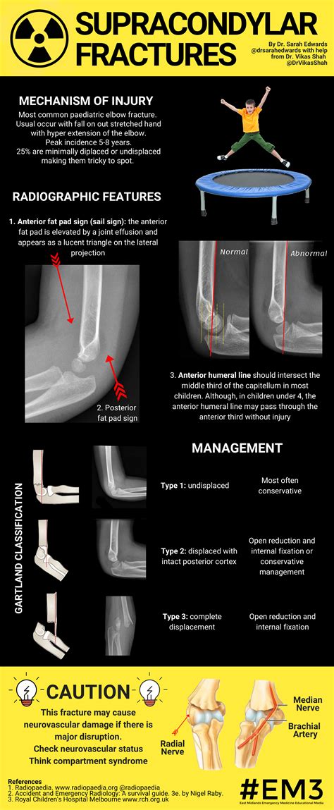 Occult supracondylar fracture treatment - headsmine