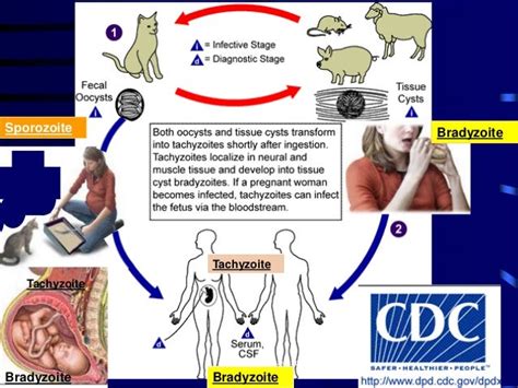 Toxoplasmosis in pregnancy