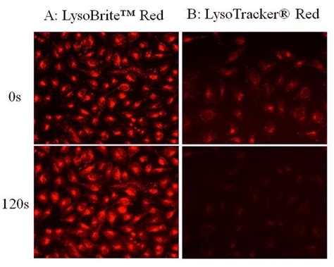 Cell Navigator® Lysosome Staining Kit *Red Fluorescence* | AAT Bioquest