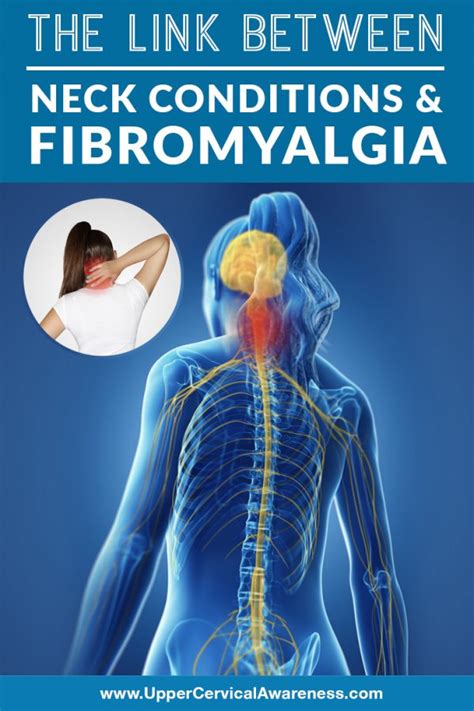 Fibromyalgia Natural Treatment | 3 Connections to the Neck