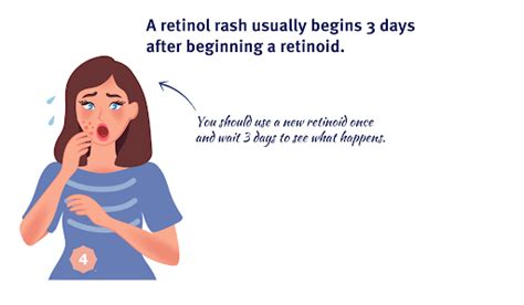 Retinol Rash and Other Retinoid Side Effects On Skin