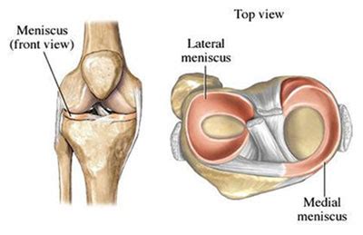 Knee Meniscus Tear | Knee Surgeon in Mumbai | Dr. Amyn Rajani