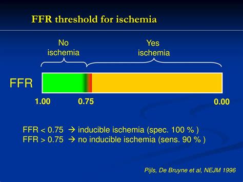 PPT - FFR Going Beyond Angiography PowerPoint Presentation, free ...