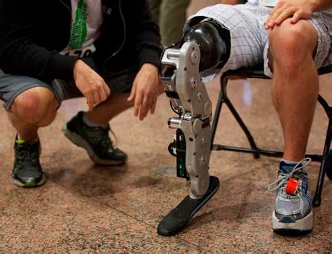 Man controls new prosthetic leg using thought alone | New Scientist