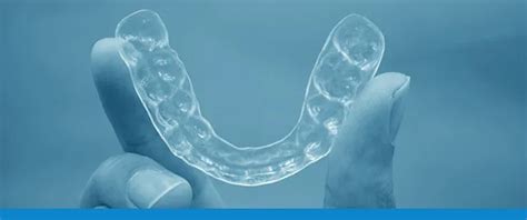 Aligner Preferences – OrthoED – OrthoTraining