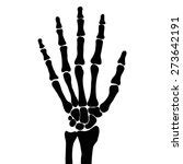 Skeleton Hand Free Stock Photo - Public Domain Pictures