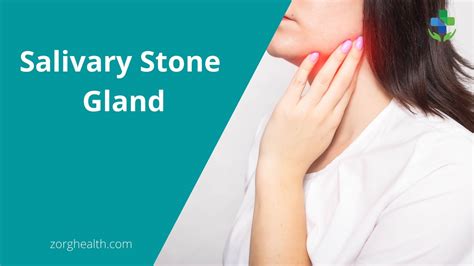 Salivary stone gland Causes, Symptoms and Surgery - Zorg Health