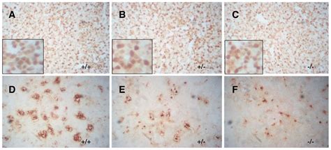 Immunohistochemical staining for a cell proliferation marker, PCNA, in ...