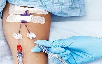 Care and Maintenance of Peripheral and Midline Catheters - Pedagogy ...