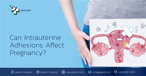 Can Intrauterine Adhesions Affect Pregnancy? | Jetanin