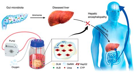 Artificial Liver