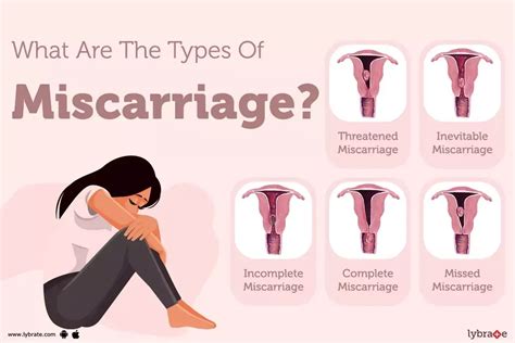 Miscarriage: Signs, Symptoms, Treatment And Prevention