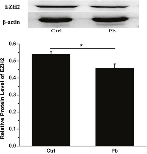 Multiple regulatory aspects of histone methyltransferase EZH2 in Pb ...