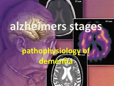 Pathophysiology of dementia