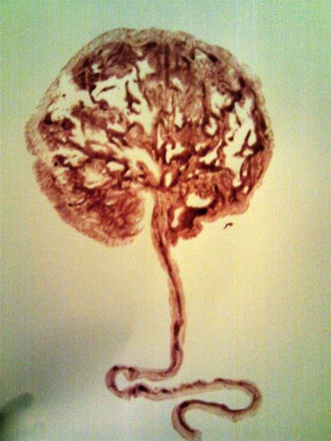 Honoring the Placenta Through Art: Making Tree of Life Placenta Prints - Tree of Life Placenta ...