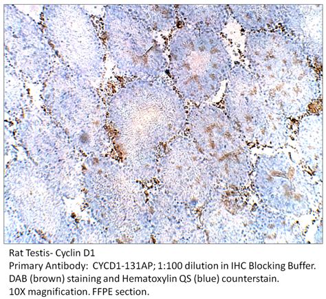 Cyclin D1 Antibody CYCD1-131AP | FabGennix