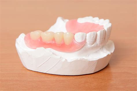 Flexible Partial Denture Repair | Denture Helper