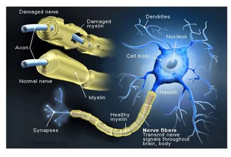 Multiple Sclerosis (MS) Symptoms and Treatment - 什么是新万博,万博betmanx官方