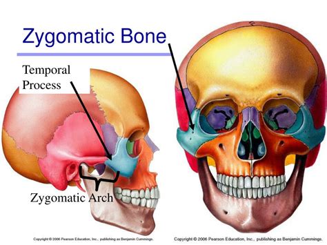 Zygomatic Arkadium