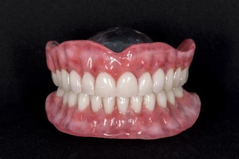 Complete Dentures - Smile Again Denture Clinic