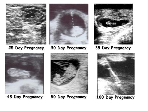 Ultrasound Pregnancy Diagnosis In Cow - All About Cow Photos