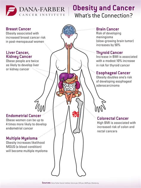 Can Obesity Cause Cancer?