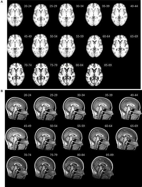 Frontiers | Age-specific MRI brain and head templates for healthy adults from 20 through 89 ...