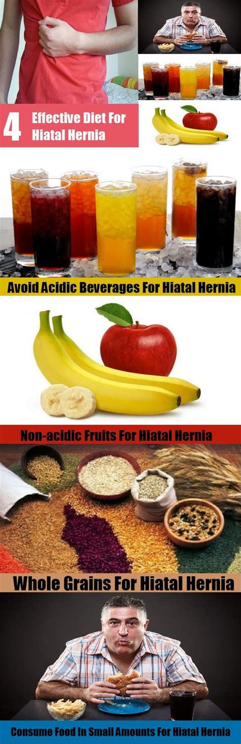 High hiatal hernia diet – Prnso