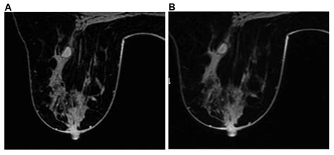 Diagnostic evaluations of ultrasound and magnetic resonance imaging in ...