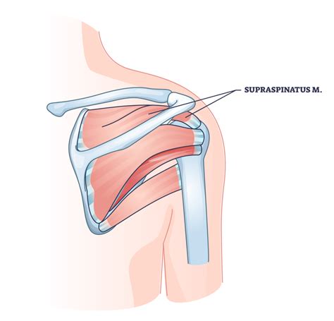 3 Best Supraspinatus Exercises (with Pictures!) - Inspire US