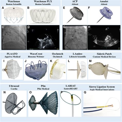 Percutaneous Left Atrial Appendage Closure | Circulation ...