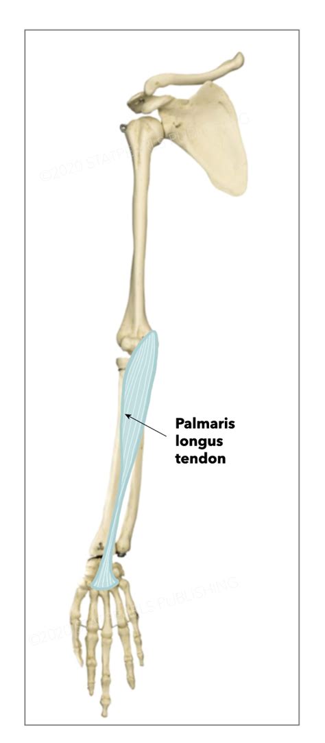 Anatomy, Shoulder and Upper Limb, Hand Palmaris Tendon Article