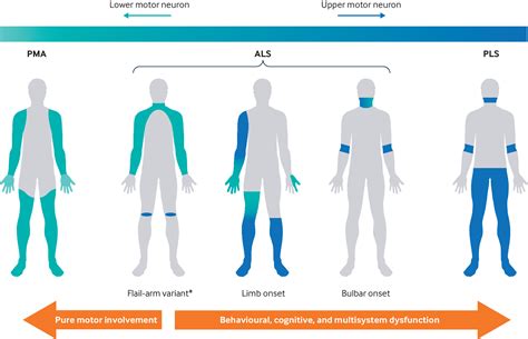 Upper Motor Neuron Disease Definition - Infoupdate.org