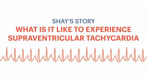 SVT and Me (Part 1): What it’s like to experience supraventricular tachycardia (SVT) - Cardiogram