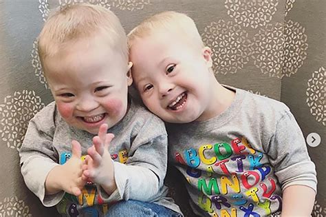 Identical Twins One With Down Syndrome