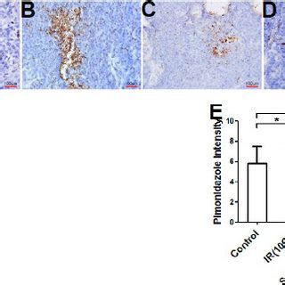 Immunostaining analysis of pimonidazole expression in xenografts. A ...