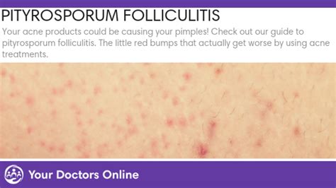 Pityriasis Folliculitis