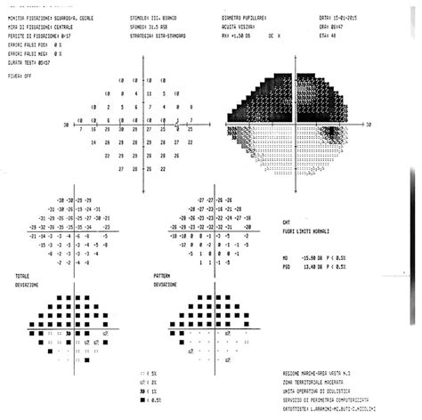 Visual field examination demonstrated a superior hemianopsia in the... | Download Scientific Diagram