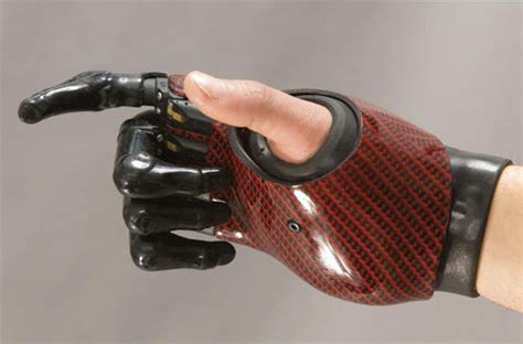 Myo-electric partial hand prosthesis - Protunix - multi-articulated / adult