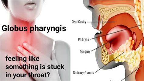 Salivary Gland, Cavities, Throat, Feelings, Health, Globe, Health Care ...