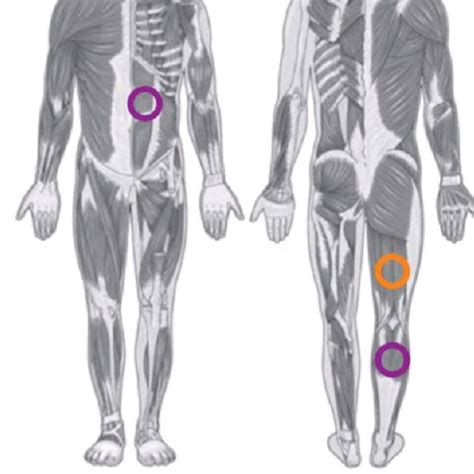 Hamstring Curl TRX by Anthony Dubs - Comment faire de l'exercice - Skimble