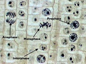 Onion Root Cell Cycle Lab Answers | SchoolWorkHelper