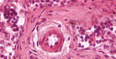 Pathology Slides