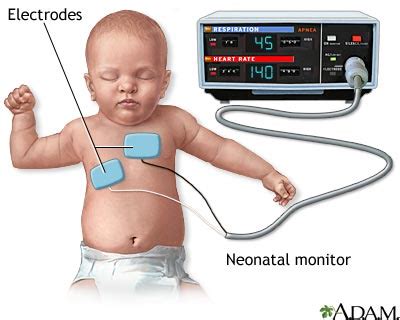 Heart - respiratory monitor : MedlinePlus Medical Encyclopedia Image