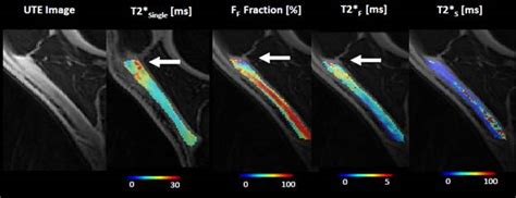 MSK Research Program – Department of Radiology – UW–Madison