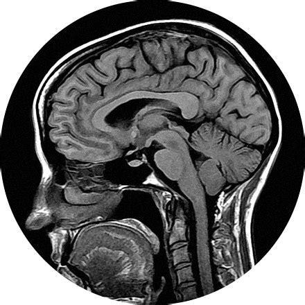 MRI | Advanced Radiology