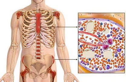 Pancytopenia: causes, symptoms and treatment – Healthy Food Near Me