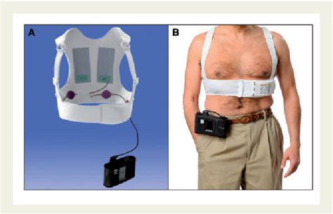 Figure 1 from Indications and use of the wearable cardiac defibrillator ...