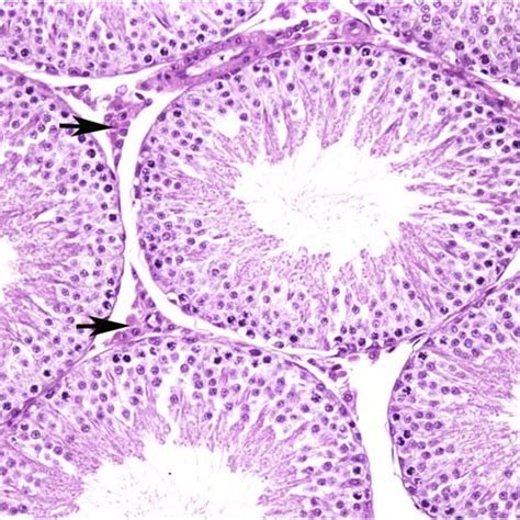 (PDF) Human Relevance of Rodent Leydig Cell Tumors